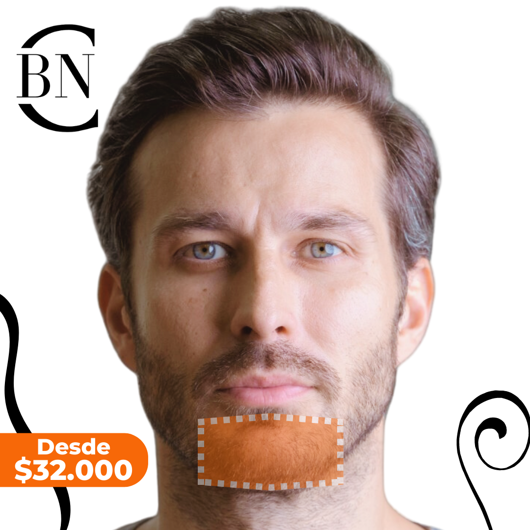 Láser Soprano Depilacion Definitiva En Barba Laser Pomulos Hombre