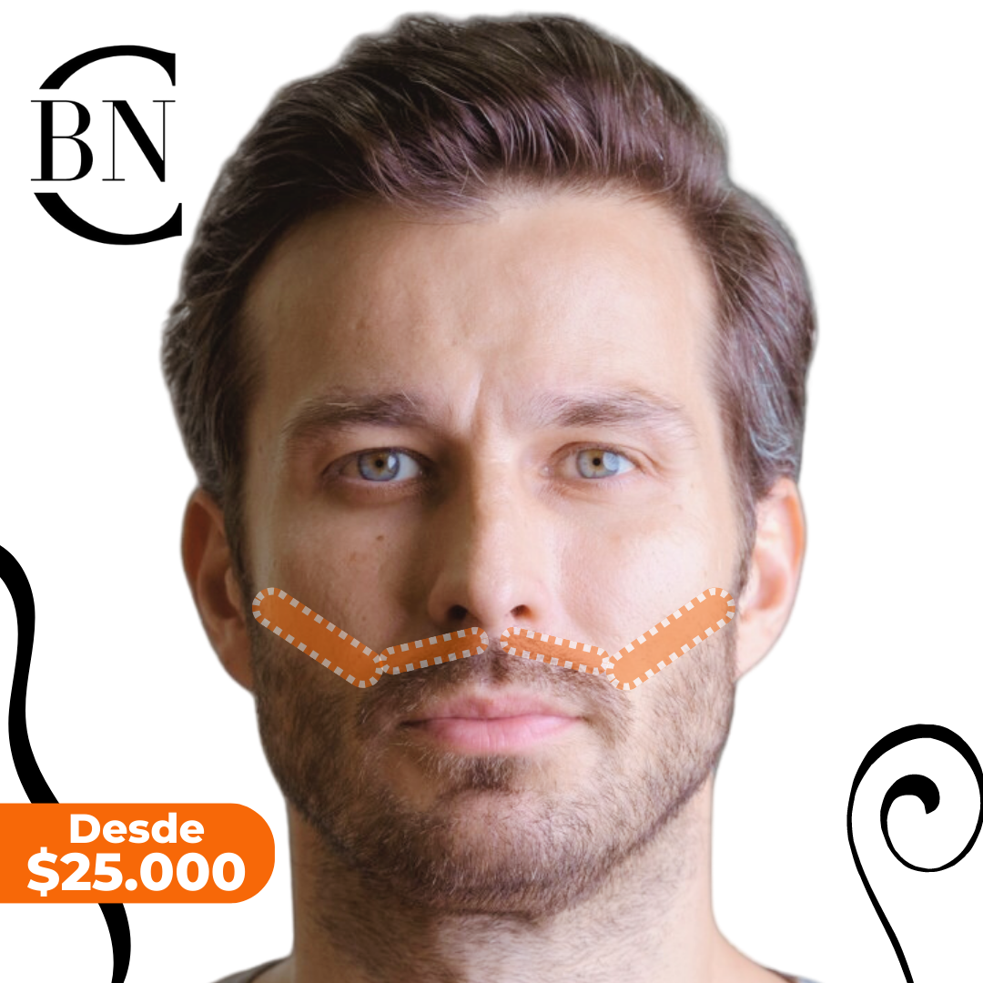 Laser Bigote DepilaciÃ³n Laser Hombre Láser Diodo Laser Facial