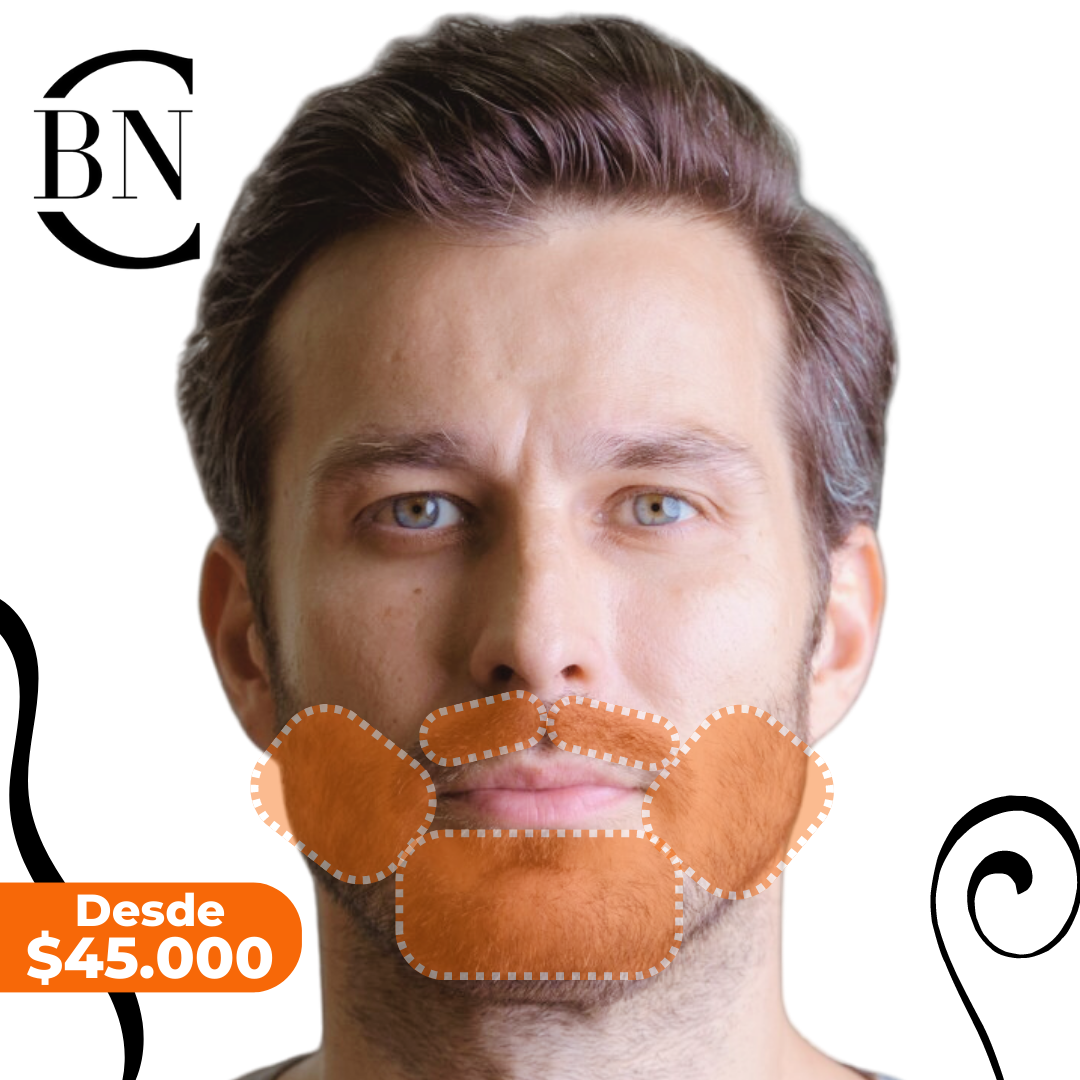 Depilación Definitiva Laser En La Barba 50% De Dcto Láser